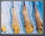 Follicular Units