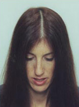 Hair Transplantation